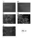 Fig. 11 - Three dimensional cell culture compositions and methods of use