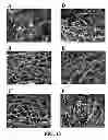 Fig. 14 - Three dimensional cell culture compositions and methods of use