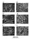 Fig. 16 - Three dimensional cell culture compositions and methods of use