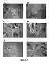 Fig. 20 - Three dimensional cell culture compositions and methods of use