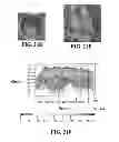 Fig. 23 - Three dimensional cell culture compositions and methods of use