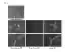 Fig. 03 - Conversion of somatic cells to induced reprogrammed neural stem cells (irNSCs)