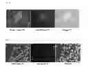 Fig. 04 - Conversion of somatic cells to induced reprogrammed neural stem cells (irNSCs)