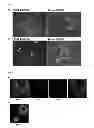 Fig. 07 - Conversion of somatic cells to induced reprogrammed neural stem cells (irNSCs)