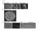 Fig. 10 - Conversion of somatic cells to induced reprogrammed neural stem cells (irNSCs)
