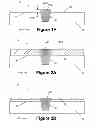 Fig. 04 - Methods of forming isolation structures for semiconductor devices by performing a dry chemical removal process