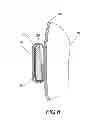 Fig. 04 - COMFORTABLE BONE-AFFIXING STRUCTURE FOR UNDERWEAR