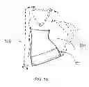 Fig. 14 - MULTI-FABRIC GARMENT