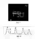 Fig. 06 - DETECTING ANALYTES USING LIPID MULTILAYER GRATINGS WITH ION CHANNELS