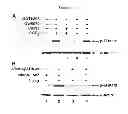 Fig. 08 - Compositions and Methods which modulate G-Protein Signaling for the Treatment of Inflammatory Disorders such as Asthma and Allergic Conjunctivitis