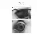 Fig. 26 - Compositions and Methods which modulate G-Protein Signaling for the Treatment of Inflammatory Disorders such as Asthma and Allergic Conjunctivitis