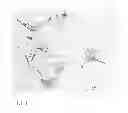 Fig. 02 - Pharmaceutical composition for treating hyperproliferative diseases
