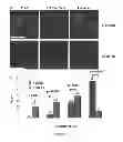 Fig. 02 - Compositions and Methods for Treating Myotonic Dystrophy Type 1