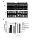 Fig. 07 - COMPOSITIONS AND METHODS FOR TREATING DEGENERATIVE MUSCLE CONDITIONS