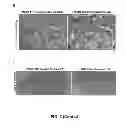 Fig. 10 - COMPOSITIONS AND METHODS FOR TREATING DEGENERATIVE MUSCLE CONDITIONS