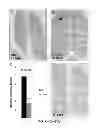 Fig. 22 - COMPOSITIONS AND METHODS FOR TREATING DEGENERATIVE MUSCLE CONDITIONS