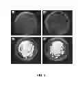 Fig. 05 - Method for treatment of disease caused or aggravated by microorganisms or relieving symptoms thereof