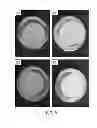 Fig. 07 - Method for treatment of disease caused or aggravated by microorganisms or relieving symptoms thereof