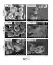 Fig. 12 - Method for treatment of disease caused or aggravated by microorganisms or relieving symptoms thereof