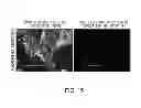 Fig. 16 - Method for treatment of disease caused or aggravated by microorganisms or relieving symptoms thereof