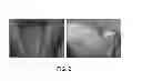 Fig. 22 - Method for treatment of disease caused or aggravated by microorganisms or relieving symptoms thereof