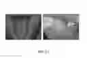 Fig. 23 - LOW-TACK SURFACE ANTI-MICROBIAL COATING COMPOSITION AND METHOD OF APPLICATION