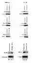 Fig. 06 - Methods targeting miR-128 for regulating cholesterol/lipid metabolism
