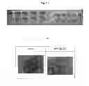 Fig. 02 - Continuous administration of L-dopa, dopa decarboxylase inhibitors, catechol-O-methyl transferase inhibitors and compositions for same
