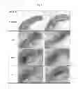 Fig. 03 - Continuous administration of L-dopa, dopa decarboxylase inhibitors, catechol-O-methyl transferase inhibitors and compositions for same