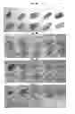 Fig. 06 - Continuous administration of L-dopa, dopa decarboxylase inhibitors, catechol-O-methyl transferase inhibitors and compositions for same