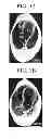 Fig. 02 - METHOD FOR PREVENTING OR TREATING ARRHYTHMIA, METHOD FOR PREVENTING OR TREATING ATRIAL FIBRILLATION, MODEL OF SUSTAINED ATRIAL FIBRILLATION, METHOD FOR PRODUCING THE MODEL, AND METHOD FOR SCREENING FOR ATRIAL FIBRILLATION INHIBITOR