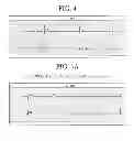 Fig. 06 - METHOD FOR PREVENTING OR TREATING ARRHYTHMIA, METHOD FOR PREVENTING OR TREATING ATRIAL FIBRILLATION, MODEL OF SUSTAINED ATRIAL FIBRILLATION, METHOD FOR PRODUCING THE MODEL, AND METHOD FOR SCREENING FOR ATRIAL FIBRILLATION INHIBITOR