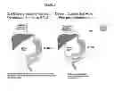 Fig. 02 - Parenteral formulations of rasagiline
