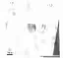 Fig. 01 - HIGH DENSITY MEMBRANE PROTEIN MEMBRANES