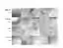 Fig. 09 - HIGH DENSITY MEMBRANE PROTEIN MEMBRANES