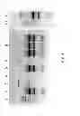 Fig. 04 - Nucleic acid purification