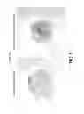 Fig. 14 - Hemostatic compositions and therapeutic regimens