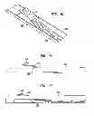 Fig. 06 - PRODUCTION OF AROMATIC CARBOXYLIC ACIDS