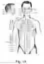 Fig. 02 - Chronic electroaccupuncture using implanted electrodes