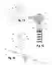 Fig. 03 - VENTRICULAR FUNCTION ASSISTING DEVICES AND METHODS OF USE THEREOF