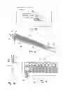 Fig. 06 - VENTRICULAR FUNCTION ASSISTING DEVICES AND METHODS OF USE THEREOF