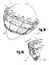 Fig. 11 - VENTRICULAR FUNCTION ASSISTING DEVICES AND METHODS OF USE THEREOF