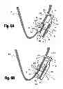 Fig. 12 - VENTRICULAR FUNCTION ASSISTING DEVICES AND METHODS OF USE THEREOF