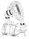 Fig. 17 - VENTRICULAR FUNCTION ASSISTING DEVICES AND METHODS OF USE THEREOF