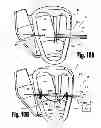 Fig. 18 - VENTRICULAR FUNCTION ASSISTING DEVICES AND METHODS OF USE THEREOF