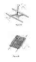 Fig. 02 - Fixating means between a mesh and mesh deployment means especially useful for hernia repair surgeries and methods thereof