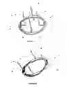 Fig. 17 - Fixating means between a mesh and mesh deployment means especially useful for hernia repair surgeries and methods thereof