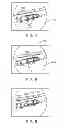 Fig. 03 - Method and device for treating dysfunctional cardiac tissue