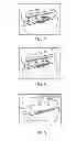 Fig. 04 - Method and device for treating dysfunctional cardiac tissue