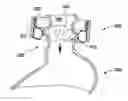 Fig. 01 - SELF-ADJUSTING GASTRIC BAND